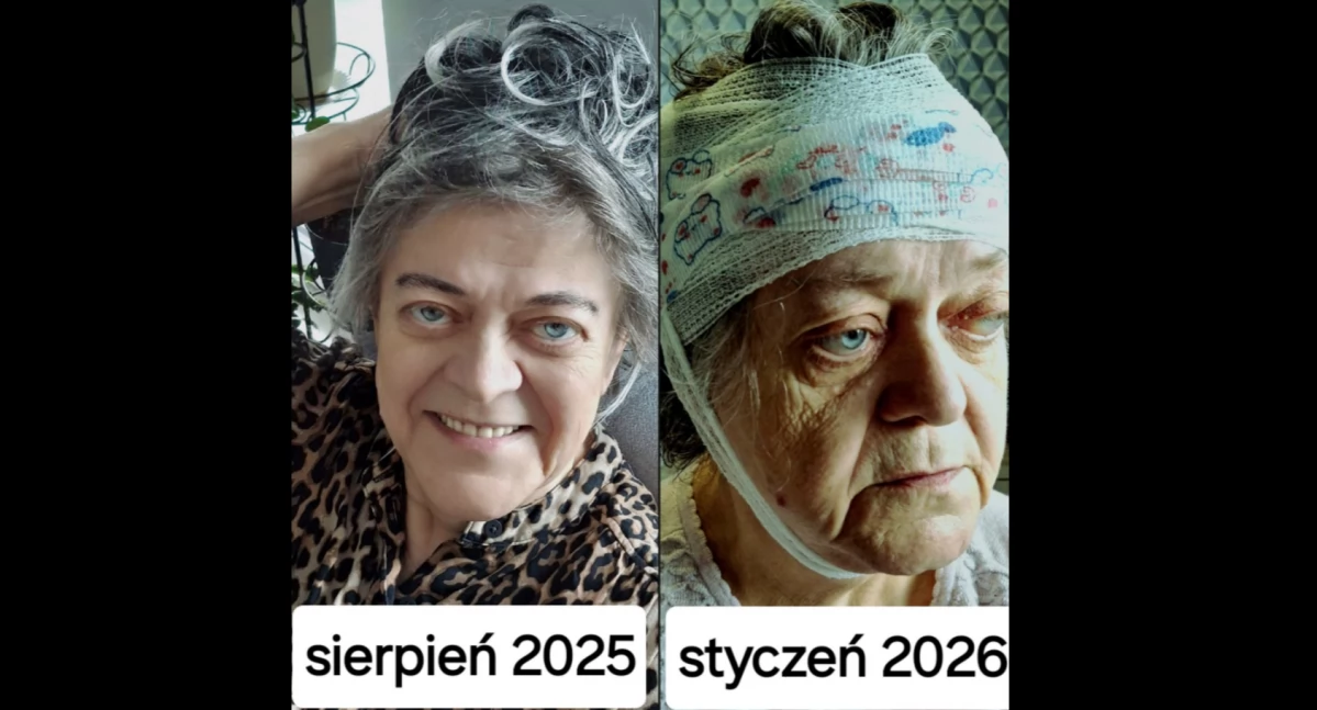 Pomoc charytatywna, Nadal potrzebna pomoc Janiny Skóry walczy rakiem dramatyczną sytuacją finansową - zdjęcie, fotografia