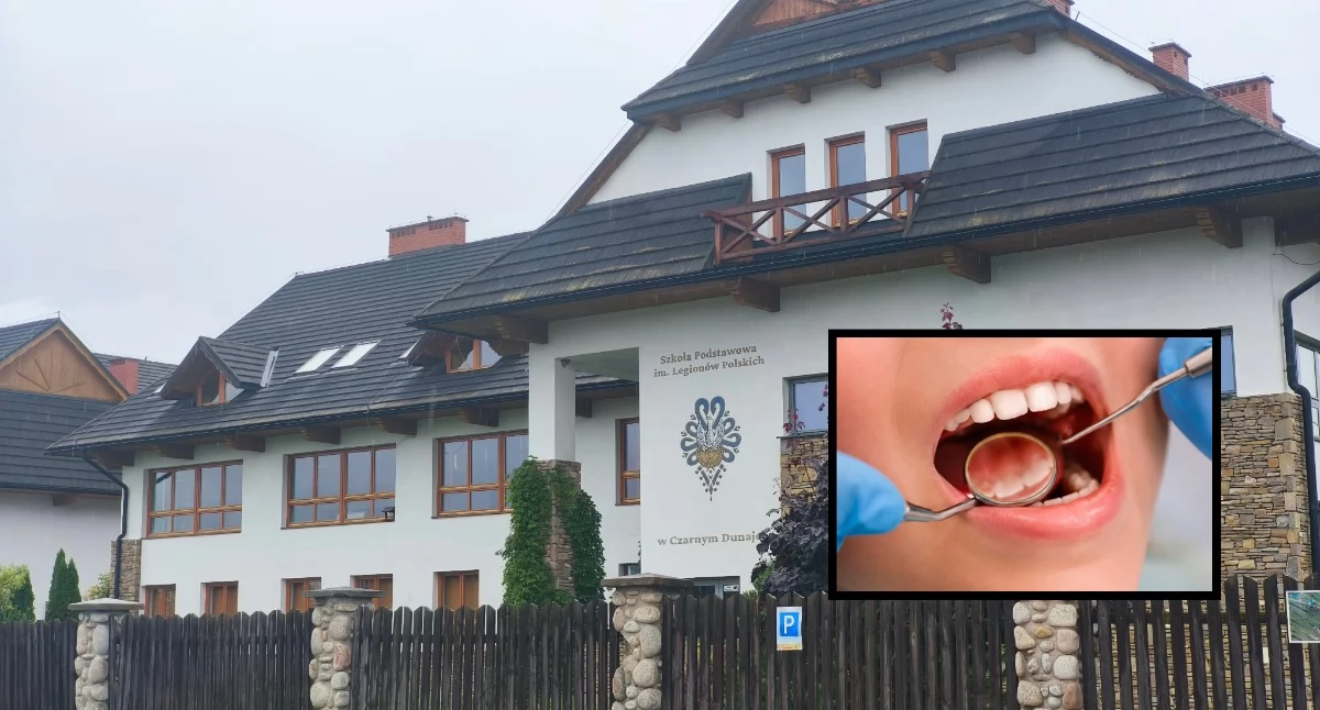Zdrowie, Akademia Uśmiechu Czarnym Dunajcu bezpłatna opieka stomatologiczna najmłodszych - zdjęcie, fotografia